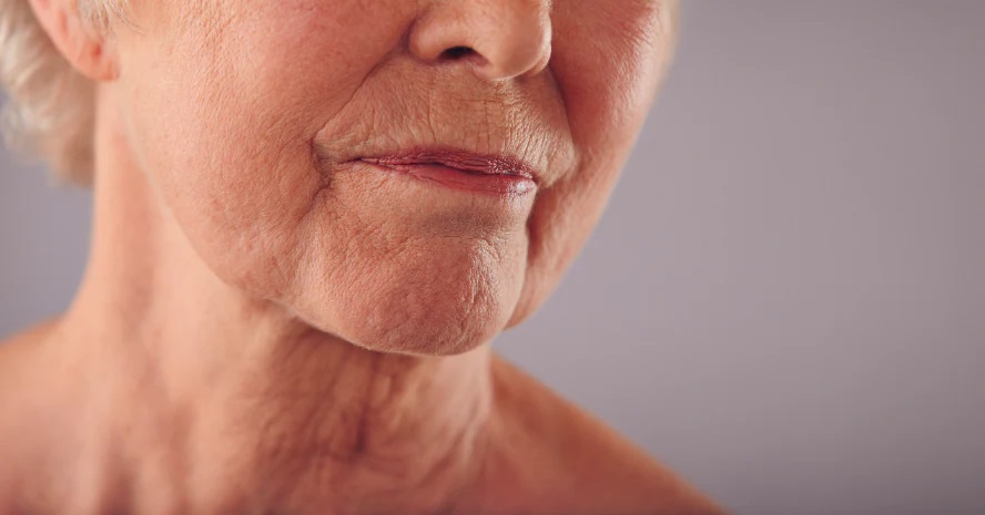 Are you facing sagging skin problems? Here’s what you must know!